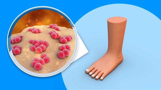 Representation of microorganisms with foot